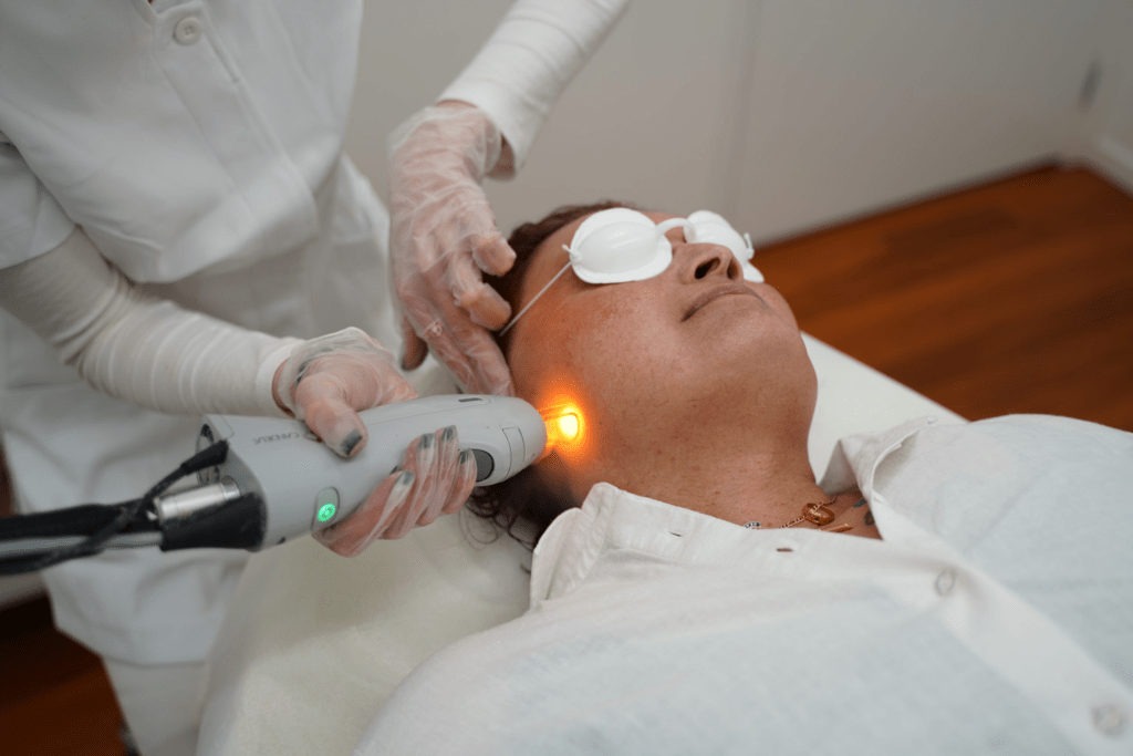 Laser facial hair removal