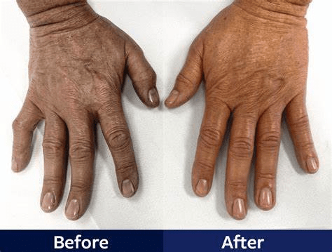 before and after a paraffin wax